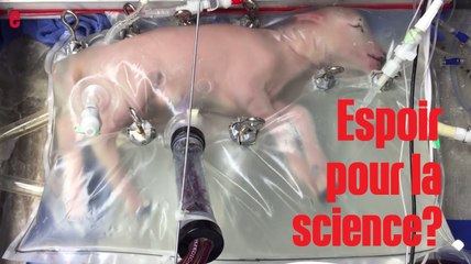 Un utérus artificiel pourrait sauver les grands prématurés
