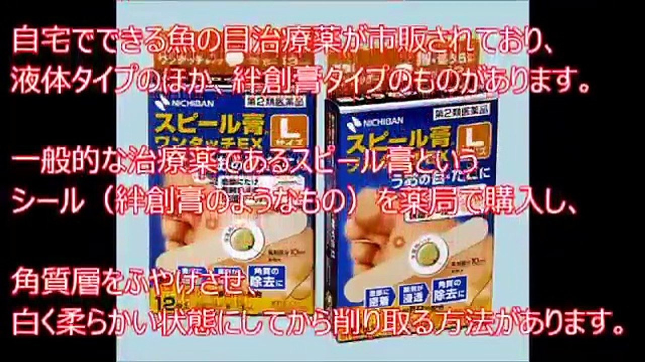 【閲覧注意】魚の目ご存知？正しい治療・除去方法はあるのか？自宅でできる魚の目の芯の正しい取り方