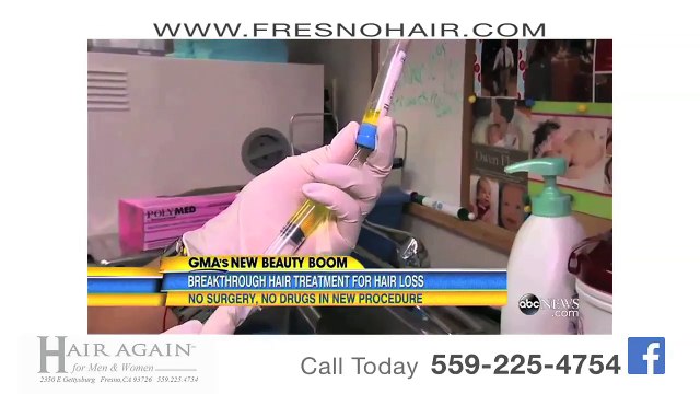 PRP- Platelet Rich Plasma Therapy in Fresno, California