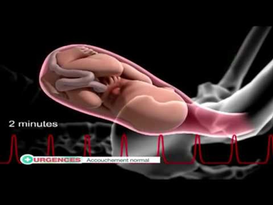URGENCE du 12 Mai 2016