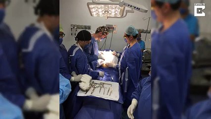 Le kyste le plus gros du monde retiré pour sauver cette femme