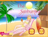 Elsa terbakar matahari Permainan - Play Elsa Sunburned Game