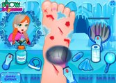 Doctor Anna Foot| Juegos de Anna Frozen | Frozen Games for Girls