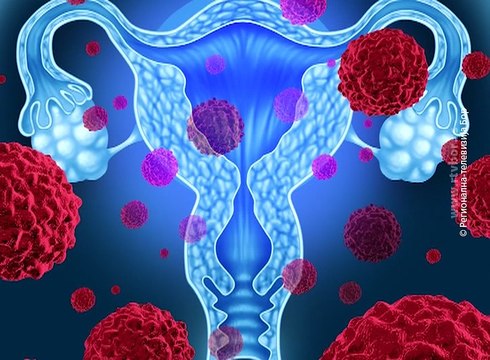 Mart – mesec borbe protiv raka, 22. mart 2017. (RTV Bor)