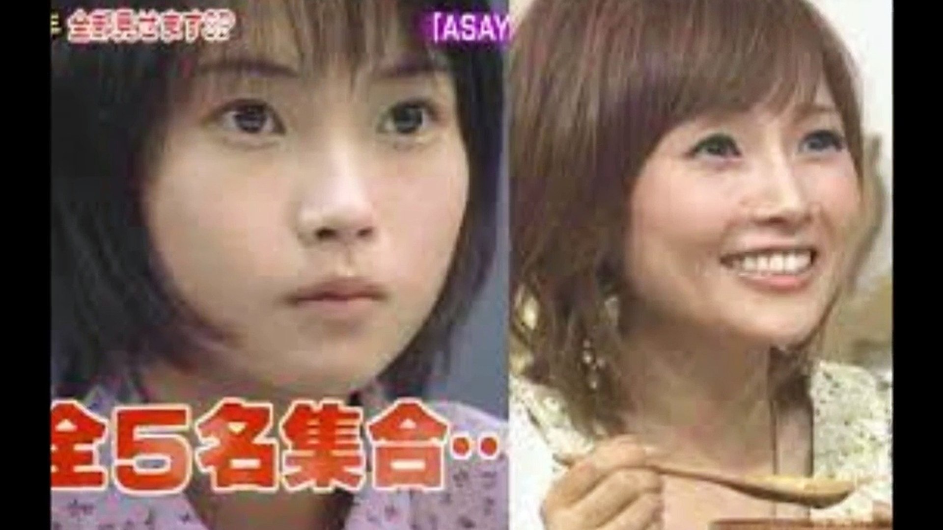 整形画像 芸能人 有名人のビフォー アフターまとめ 目頭切開 Dailymotion Video