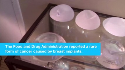 Breast implants cause rare form of cancer