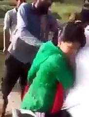 Innocent Muslim Girl Torched In Front Of Father