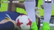 Carlos Lampe Gets Injured - Colombia vs Bolivia - World Cup Qualification - 23/03/2017