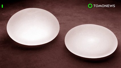 Rare cancer: Breast implants linked to nine deaths from Anaplastic Large Cell Lymphoma