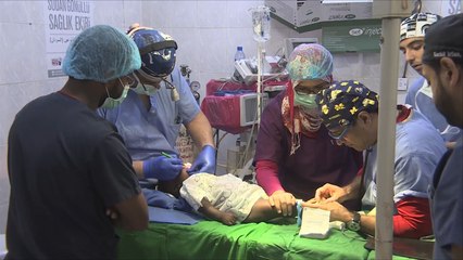 هذا الصباح- ألف عملية جراحية للشفة الأرنبية بالخرطوم