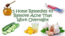 5 Home Remedies to REMOVE Acne That Work OVERNIGHT - YouTube