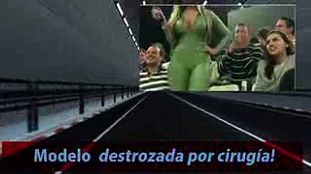 Graves secuelas de Cirugía Plástica en Modelo Brasileña