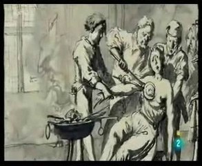 Cancer de mama: Historia de la deteccion precoz