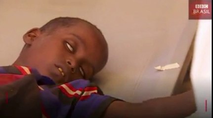 Fome na África já atinge 20 milhões de pessoas