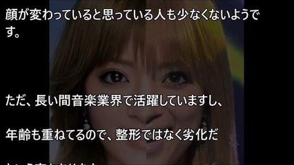 【Mステ】浜崎あゆみ劣化！現在の太った樽ボディがやばいｗｗｗ