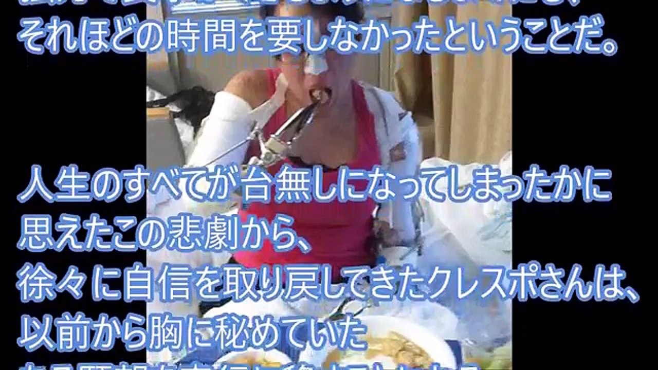 【衝撃】体の一部を欠損しているのに、ユーモアたっぷりに自分を表現する人たちに感動！