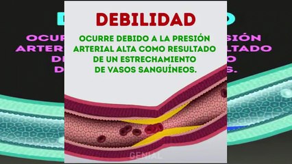 Seis señales de un ataque cardíaco