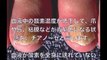 【健康】爪で診る健康。この12の症状は病気のサイン？　【マジっすか!?】【Health】 Health check with nails.
