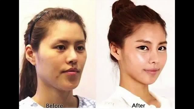 【衝撃】この美少女の整形みたら何も信じられなくなると話題。衝撃ビフォーアフターがヤバい…！？