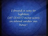 Lighten your acne scars within an hour! http://BestDramaTv.Net