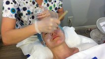 Chemical Peel for Treatment of Acne Skin http://BestDramaTv.Net