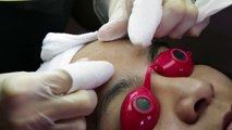 Women With Acne Get Facials For The First Time http://BestDramaTv.Net