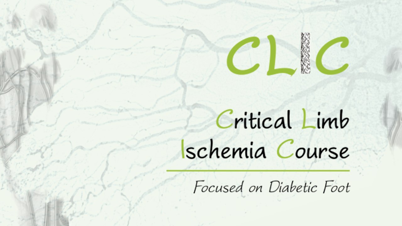 Subintimal Approach First: Wires, Why and When