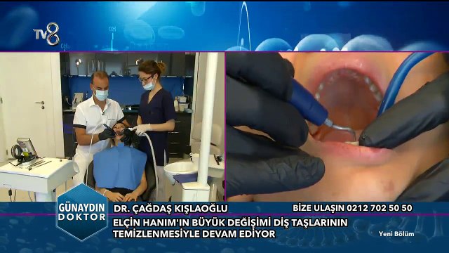 Diş Beyazlatma ve Pembe Estetik nasıl uygulanır?