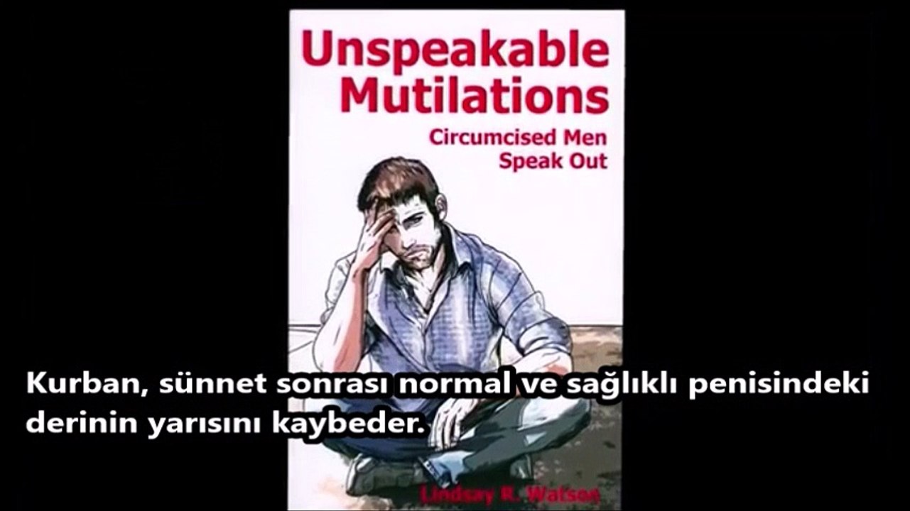 Sünnet Travması