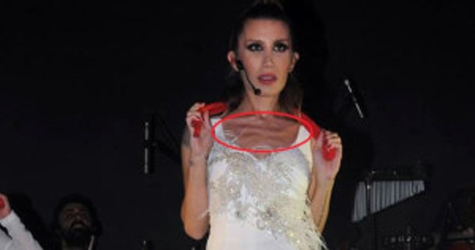 İrem Derici'nin Zayıflıktan Kemikleri Sayıldı