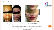 0811 1721 280, Agar wajah cantik di Jakarta Selatan Rinanda  Skin Care Center