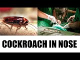 Chennai doctor takes out cockroach 'Alive' from woman's nose | Oneindia News
