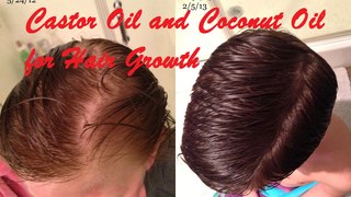 Castor Oil and Coconut Oil for Hair Growth || Home Remedies