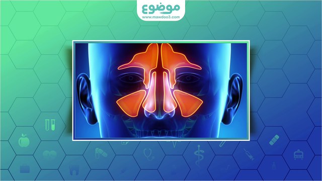 #موضوع: أسباب التهاب الجيوب الأنفية