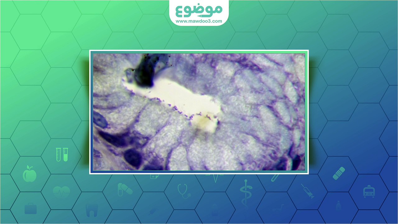 #موضوع: علاج التهاب فم المعدة