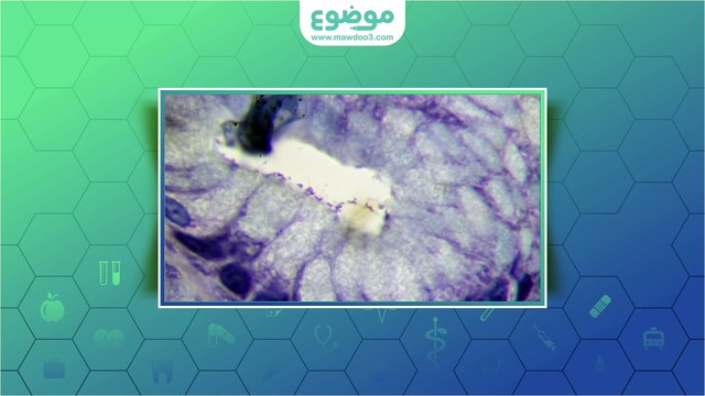 #موضوع: علاج التهاب فم المعدة