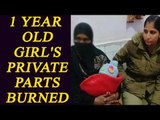 UP: 1 year old girl sexually abused and her private parts burned | Oneindia News