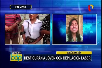 Joven queda desfigurada tras someterse a depilación láser