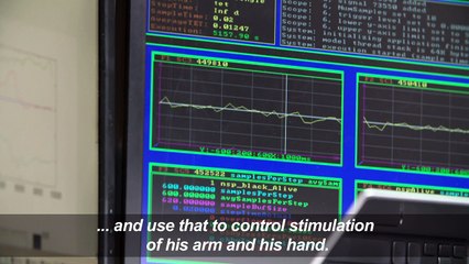 Quadriplegic man regains use of arm in medical first: study