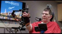 Un tetrapléjico recupera la movilidad de brazos y manos gracias a una neuroprótesis