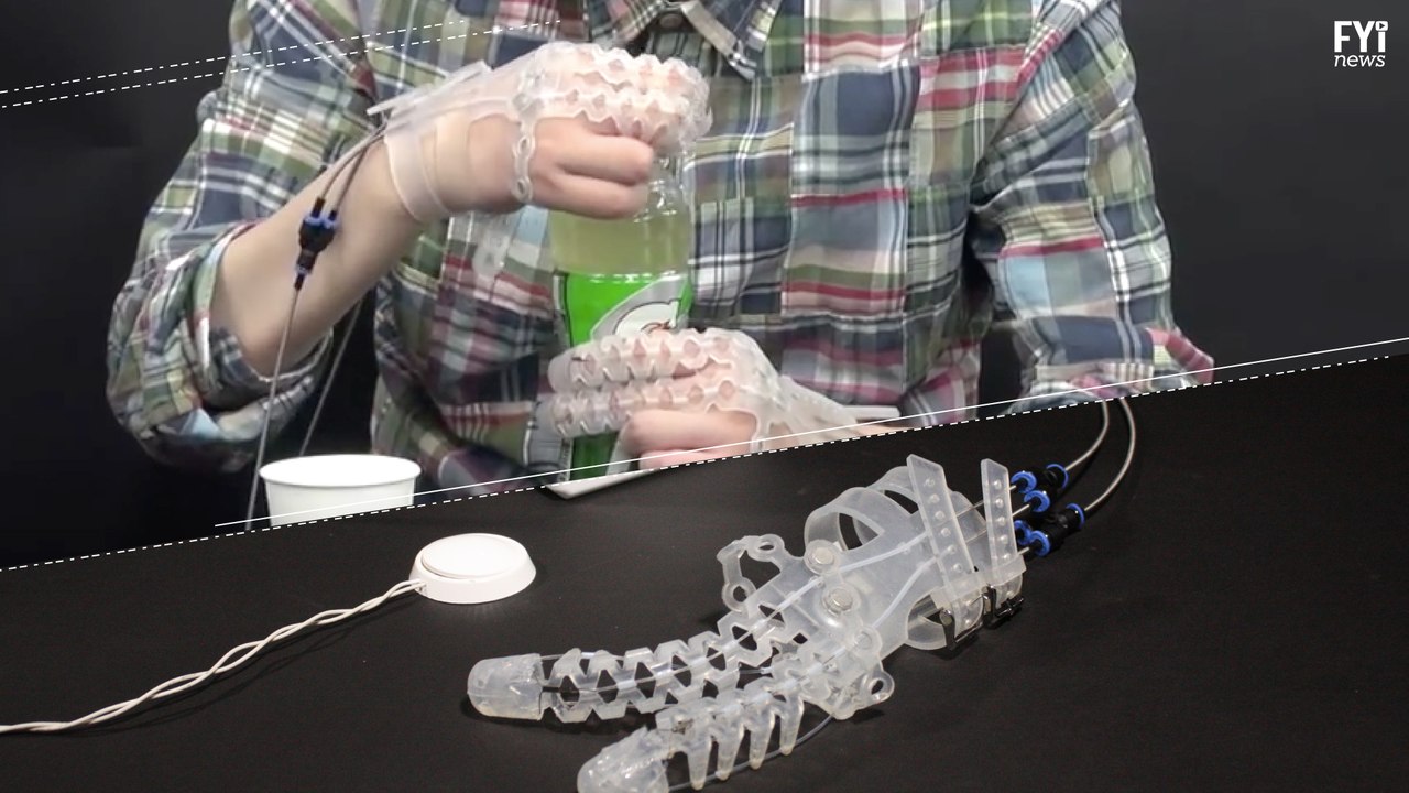 A Robotic Gloves Facilitates Mobility In Hands