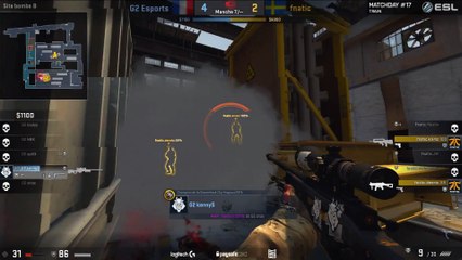 CSGO: KennyS clutch & close defuse