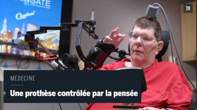 Une prothèse permet à un tétraplégique de bouger son bras grâce à la pensée