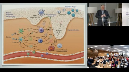 Современный взгляд на менеджмент псориатрической болезни