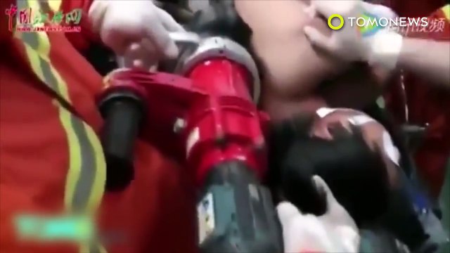 Man speared through head_ spearfishing accident goes horribly wrong, impales man’s face - TomoNews