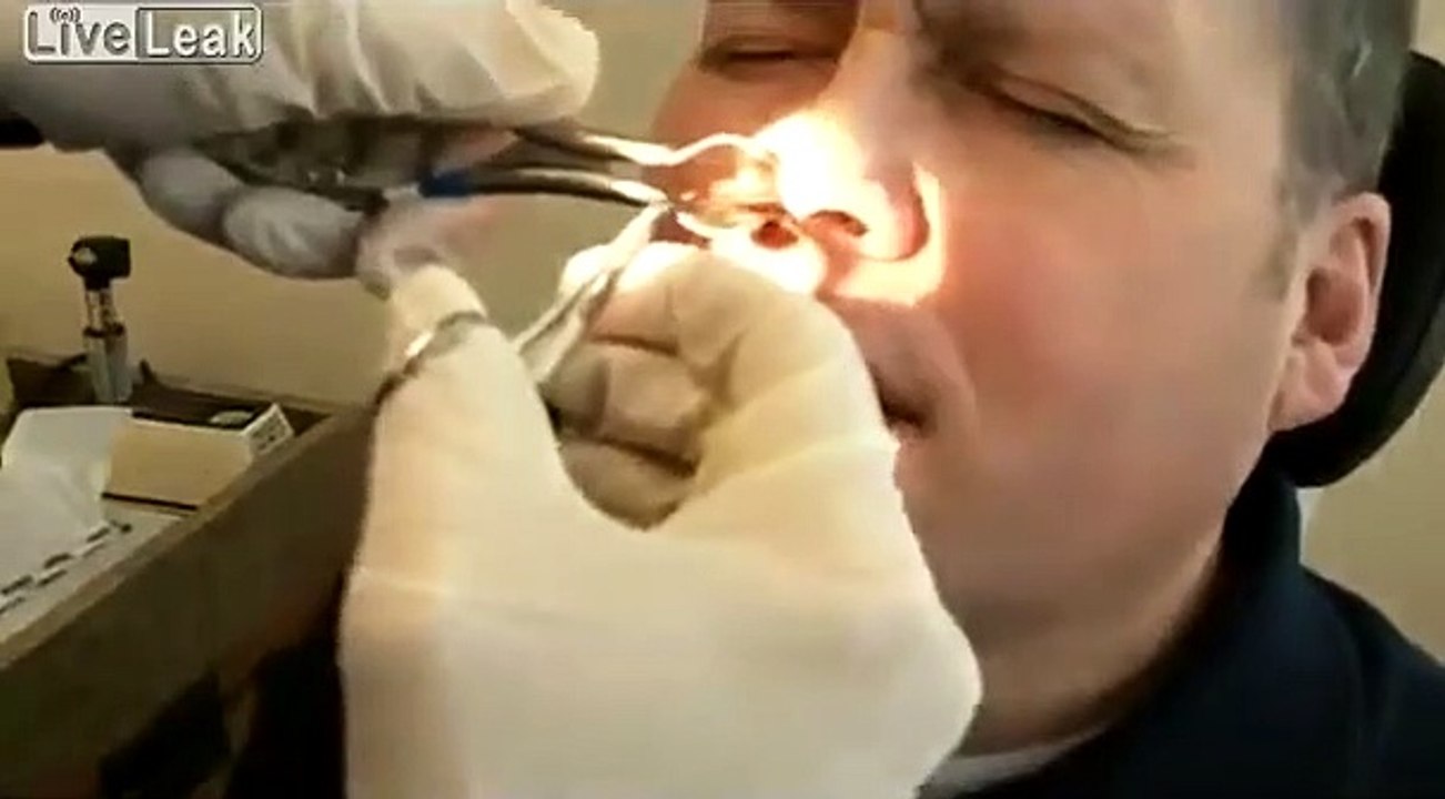 CE QUI SORT DE SON NEZ EST INCROYABLE!