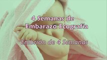 4 Semanas de Embarazo - Ecografía 4 Semanas de Gestación-J5gAwVH