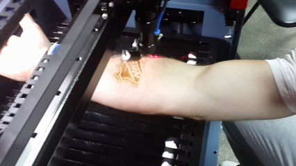 Un russe se fait graver le logo "NHL" au laser..