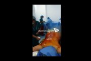 Colombian Doctors And Nurses Fired For Dancing Around Patient During Surgery