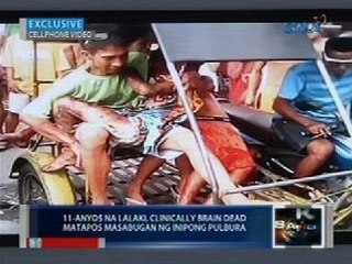 Saksi: Batang nasabugan ng inipon niyang pulbura sa Caloocan, brain dead at inilipat na ng ospital